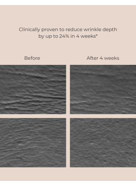 INIKA Organic Bakuchiol Serum (Natural Retinol Alternative)