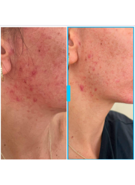 Zinzino Collagen Boozt