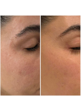 Zinzino Collagen Boozt
